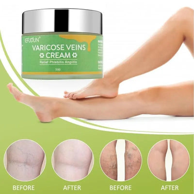 Vein Cream Red Blood Streaks Repair Earthworm Leg Bruises Bulge Relief Pain Safflower Skin care lotion Varicose Cream Wonder Loulou